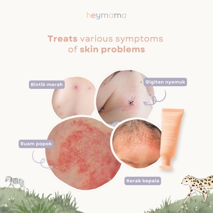 Heymama Multi Effect Wonder Balm / Balm Serbaguna Kulit Ruam