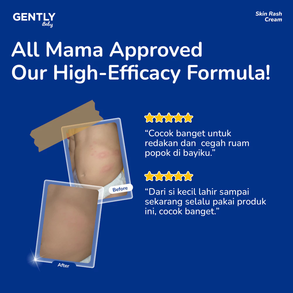 Gently Baby Skin Rash Cream / Krim Ruam Popok Anak Bayi