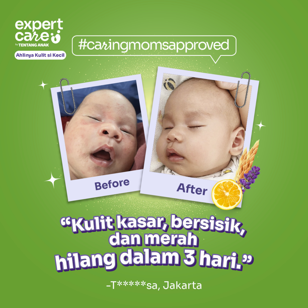 Expert Care Daily PrOATect Soothing and Calming Cream Face & Body Lotion | Moisturizer / Krim Pelembap Anak Bayi Kulit Sensitif