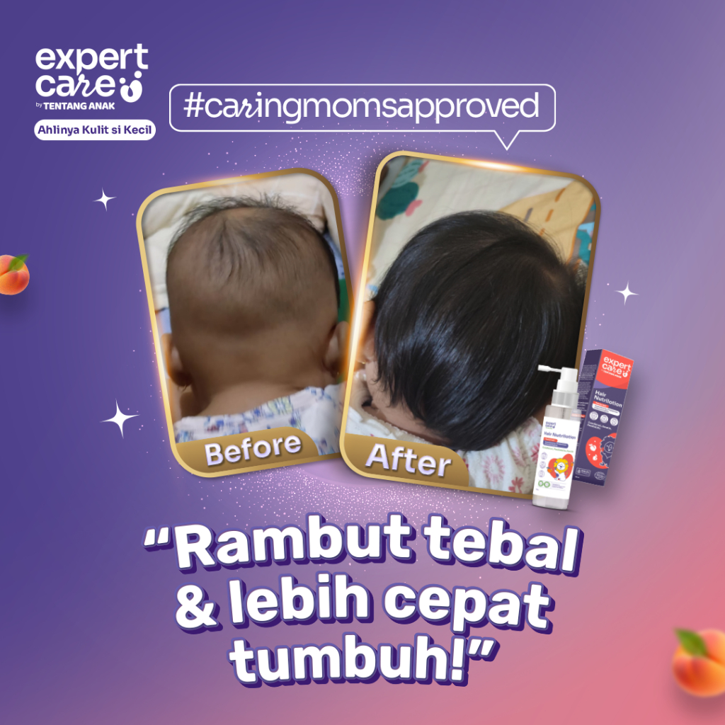 Expert Care Hair Nutrilotion / Hair Lotion Rambut Anak Bayi