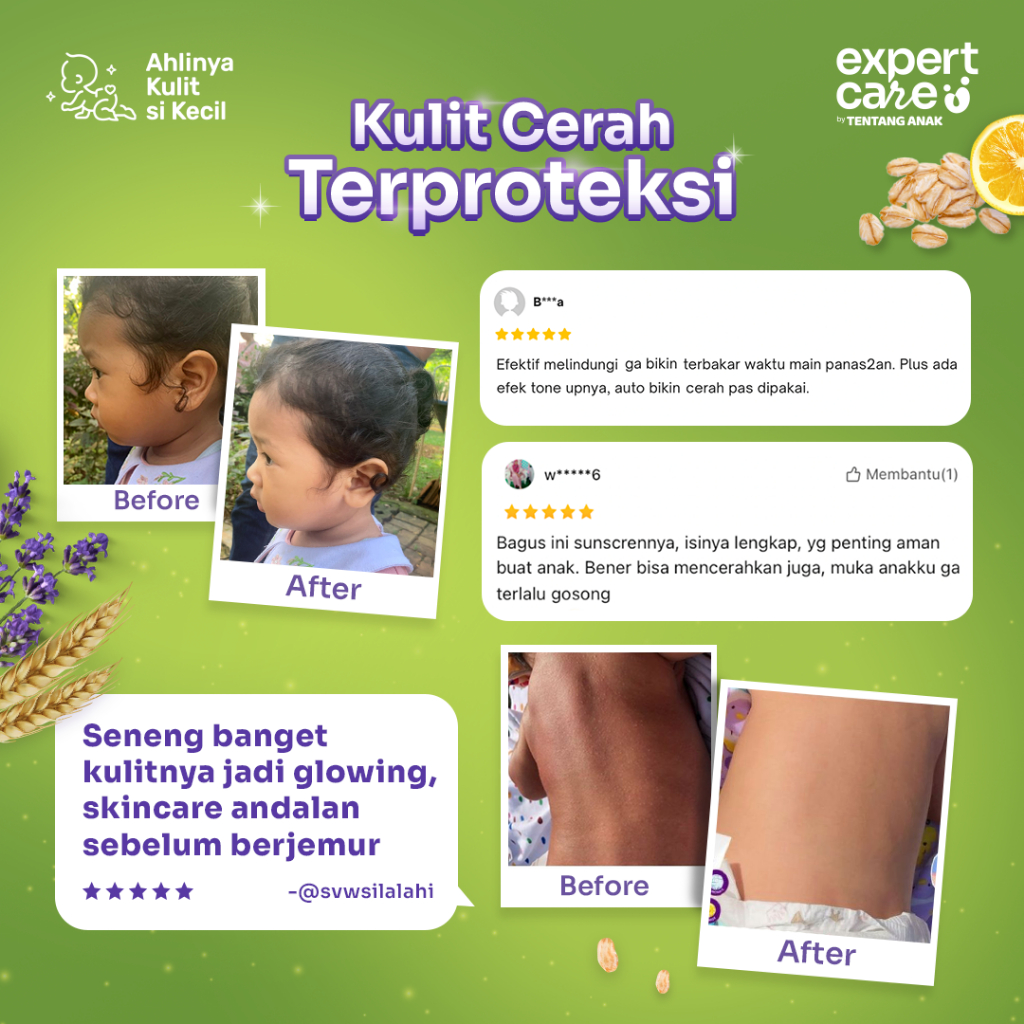 Expert Care Physical Sunscreen SPF 50+ PA+++ Daily Moisturizing Sun PrOATection / Sunblock / Krim Pelindung Kulit Sinar Matahari Anak Bayi