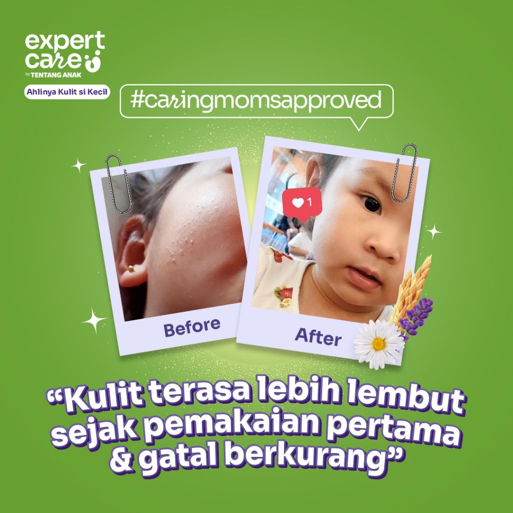 Expert Care Gentle PrOATect 2in1 Head To Toe Shampoo and Body Wash l Sampo dan Sabun Bayi Anak Kulit Sensitif