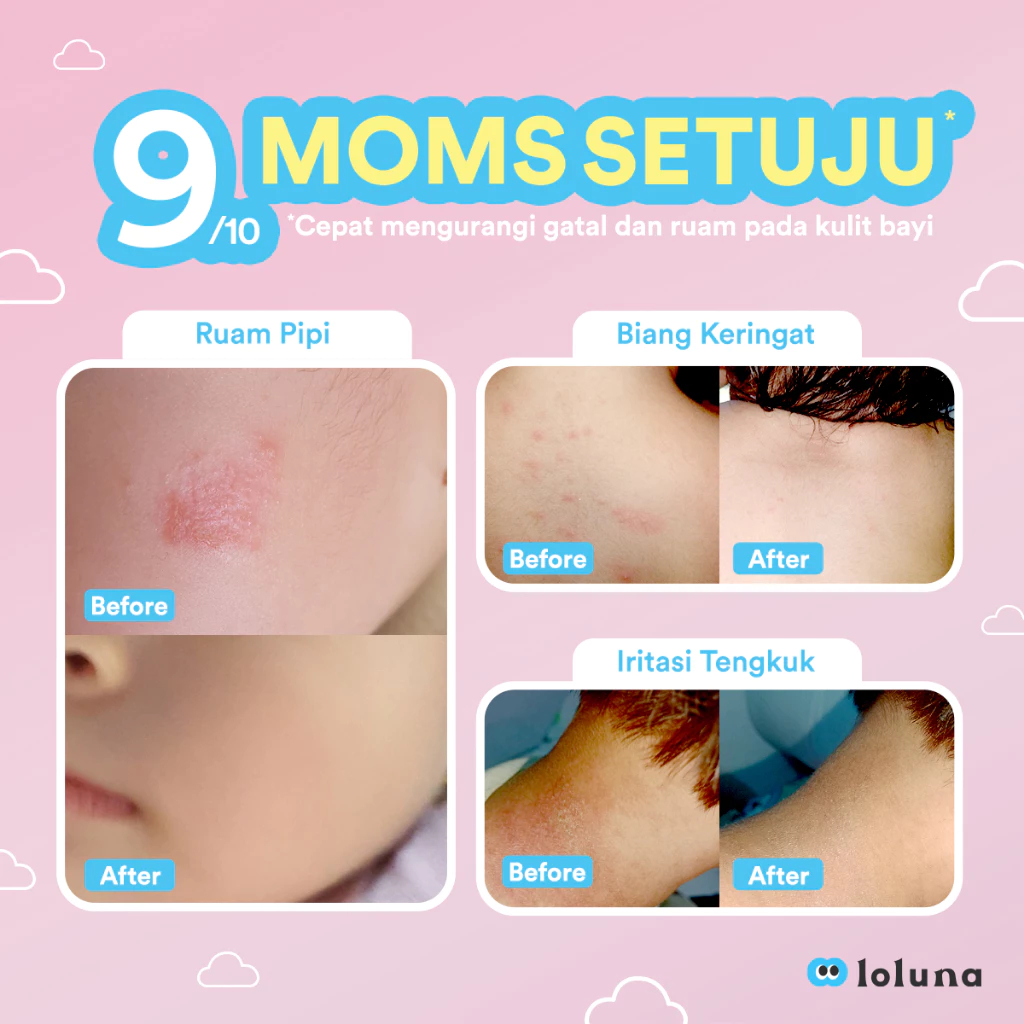 Loluna Cerapair Rash Cream / Krim Ruam Anak Bayi Ceramide Pair