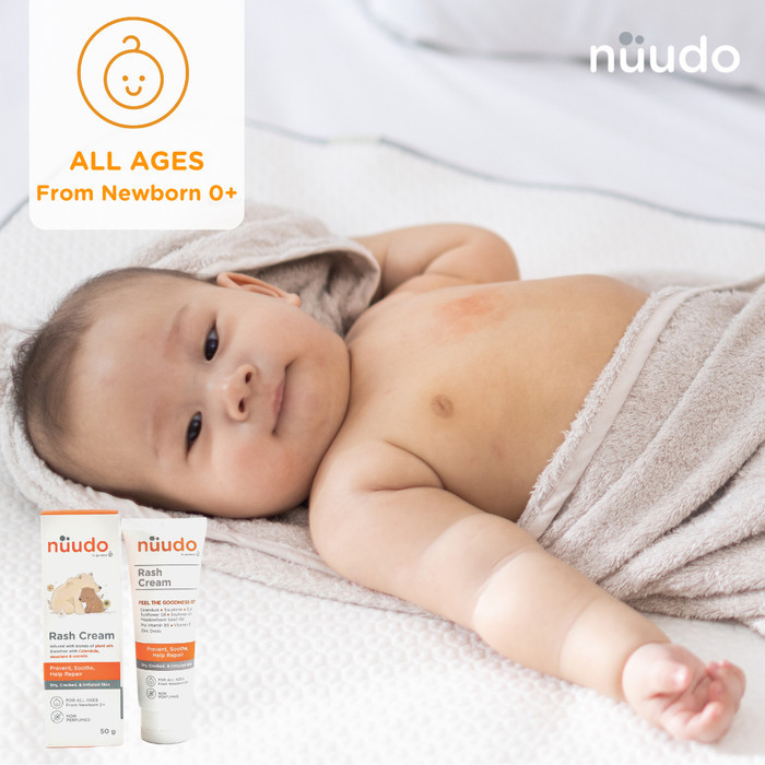 Nuudo Rash Cream / Krim Ruam Bayi